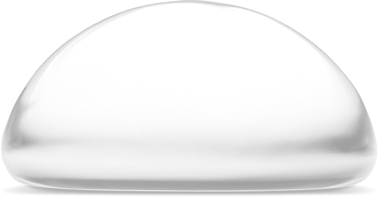 vue-latérale-ronde-classique