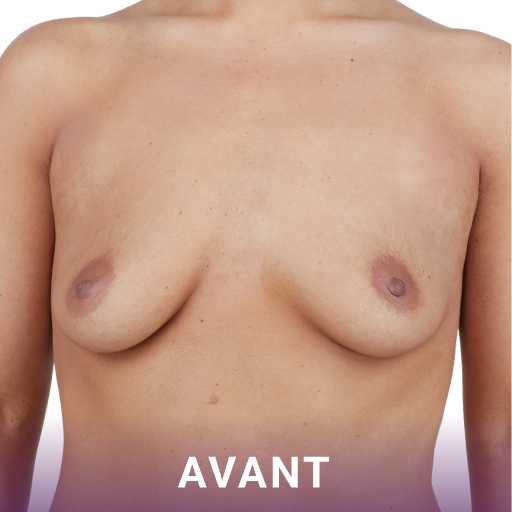 Avant image