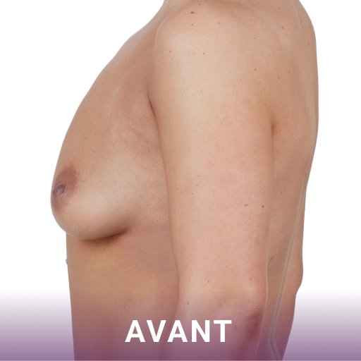 Avant image-2