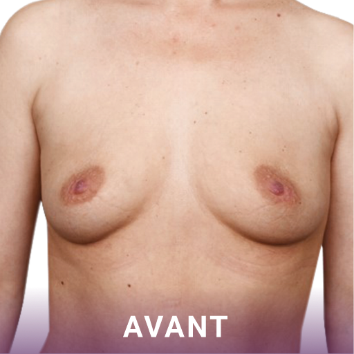 Avant image-1
