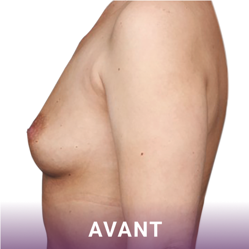 Avant image-2