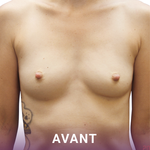 Avant image-1
