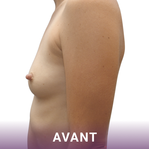 avant image-2